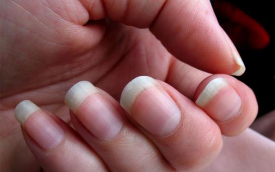 Ciseaux A Ongles Quand Utiliser Un Ciseau A Ongles Le Parisien